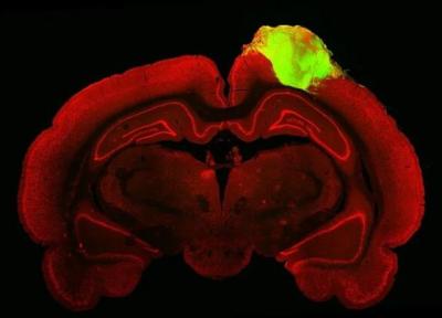 ارگانوئید مغز انسان به موش پیوند زده شد